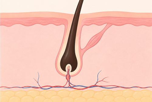 LASER-HAIR-REMOVAL_im1
