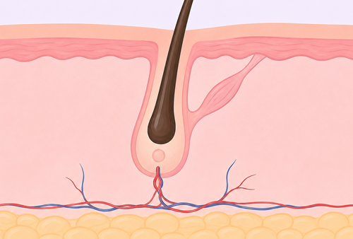 LASER-HAIR-REMOVAL_im2